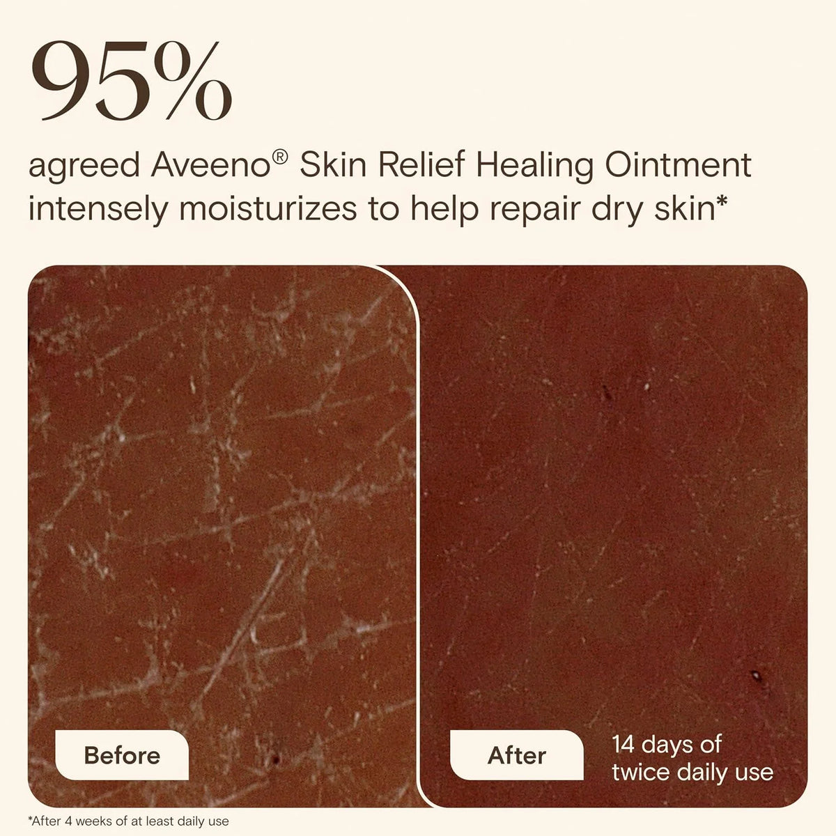 Aveeno Skin Relief Healing Ointment, Fragrance-Free, Jar 14 Ounce (Pack of 12)