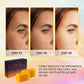 VALITIC Kojic Acid Dark Spot Remover Soap Bars, Turmeric Bar Soaps 4 Pack